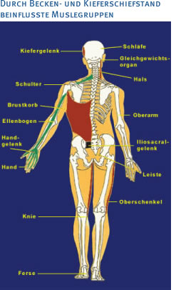 Kieferschiefstand Beeinflusste Muskelgruppen Orthodentix